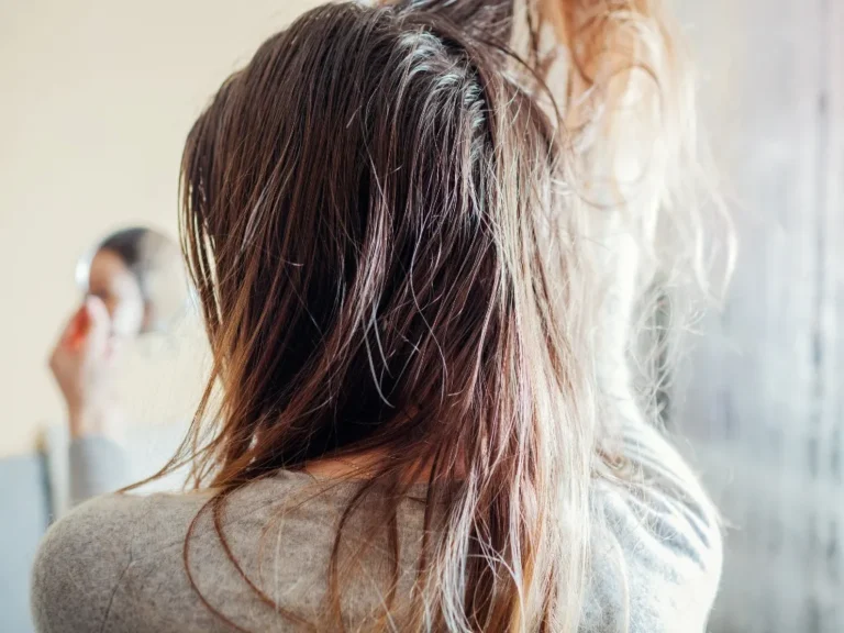 Real Causes of Oily Hair